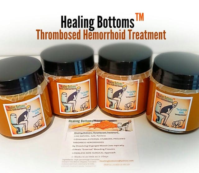 Thrombosed Hemorrhoid Excision Healing