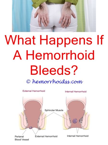Thrombosed Hemorrhoids Sitz Bath
