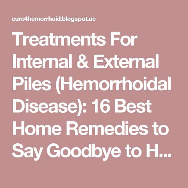 Treatments For Internal &  External Piles (Hemorrhoidal Disease): 16 ...