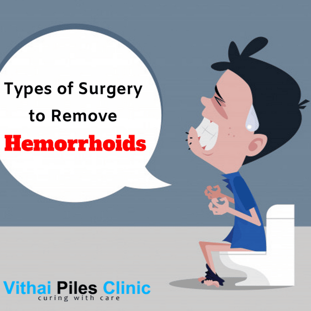 Types of Surgery for Hemorrhoids
