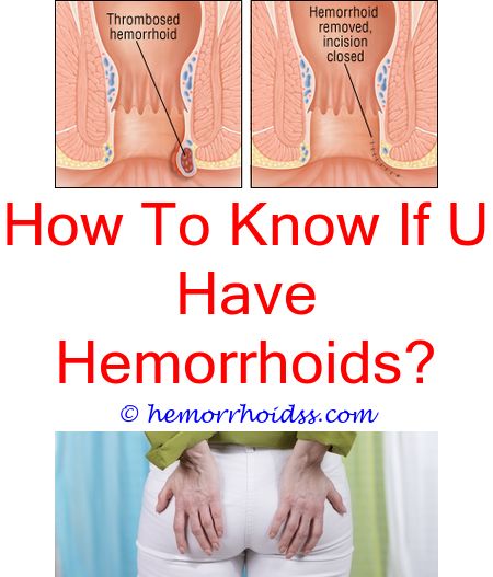 W Thrombosed Hemorrhoids