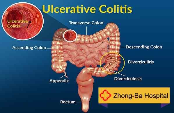 We have professional Chinese doctor " Aizhu Wang"  for the Anorectal ...