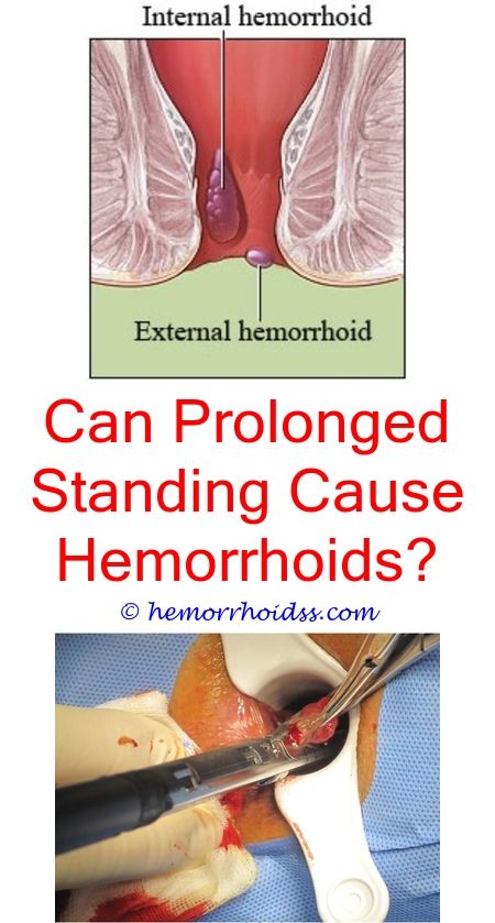What Can A Doctor Do For Hemorrhoids?