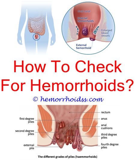 What Do Hemorrhoids Look Like On A Baby