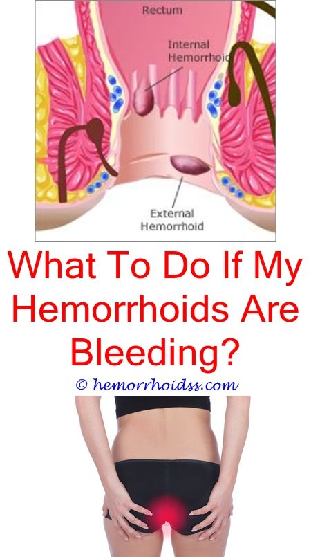 What Doctor Do I See For Hemorrhoids?