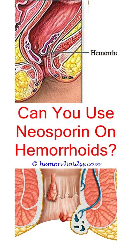 What Doctor Treats Hemorrhoids?