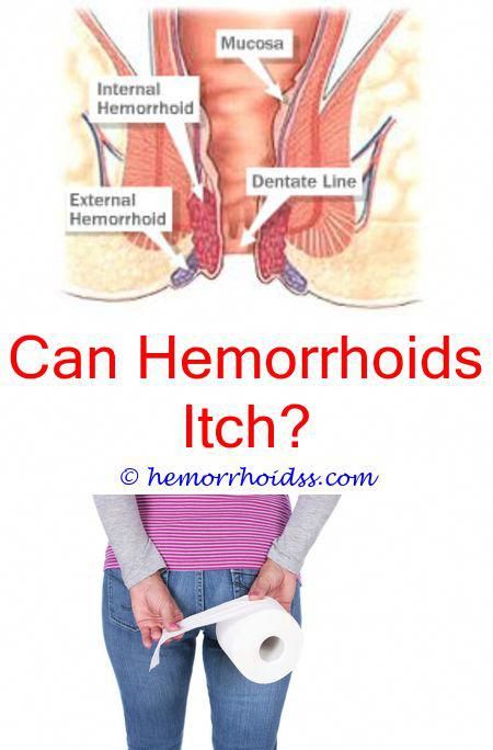 What Is Used For Hemorrhoids? what type of dr should i see ...