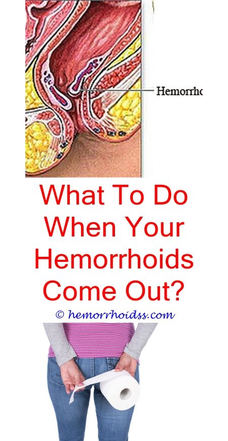What To Do When You Have Hemorrhoids?