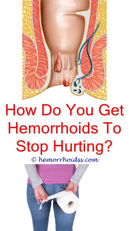 What To Put On Burning Hemorrhoids? how did you get hemorrhoids?.Are ...