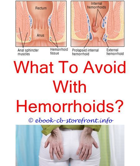 What To Use On Hemorrhoids While Pregnant