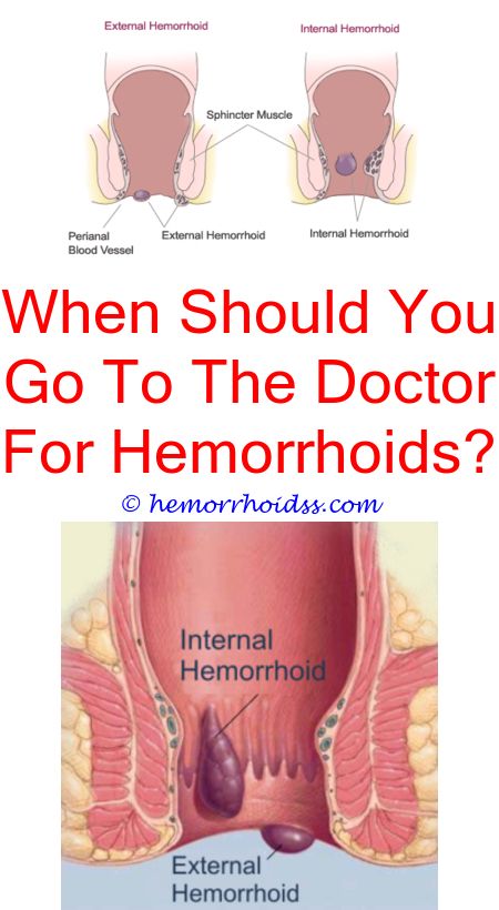When Should I See A Doctor For Bleeding Hemorrhoids