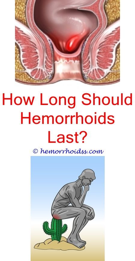 When Will My Hemorrhoid Go Away? can you get rid of ...