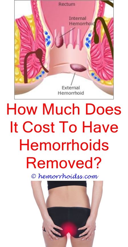 Why Do Hemorrhoids Bleed?
