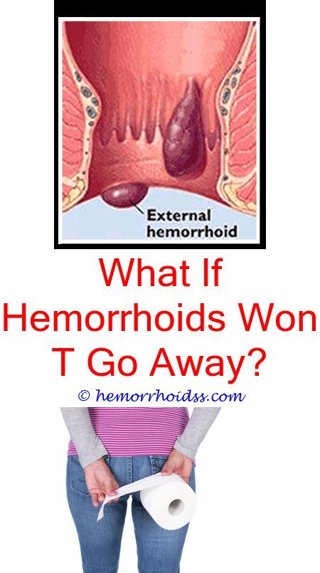 Will Hemorrhoids Cause Back Pain
