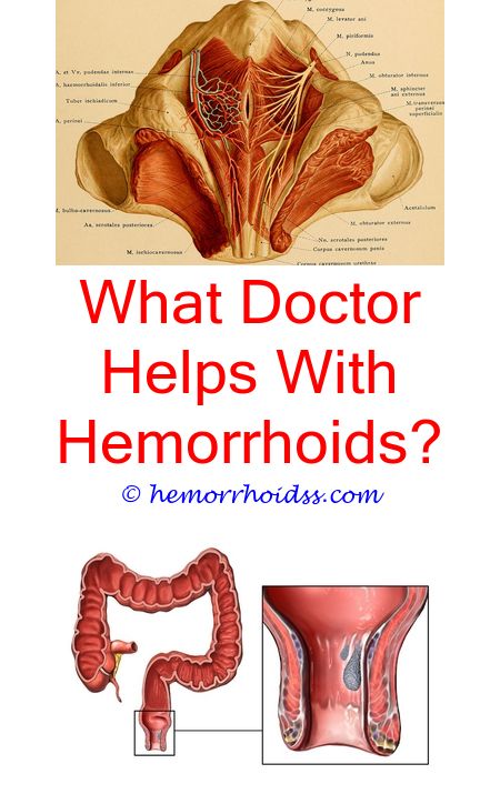 Wondrous Tips: Can I Drain A Thrombosed Hemorrhoid Myself? how can you ...